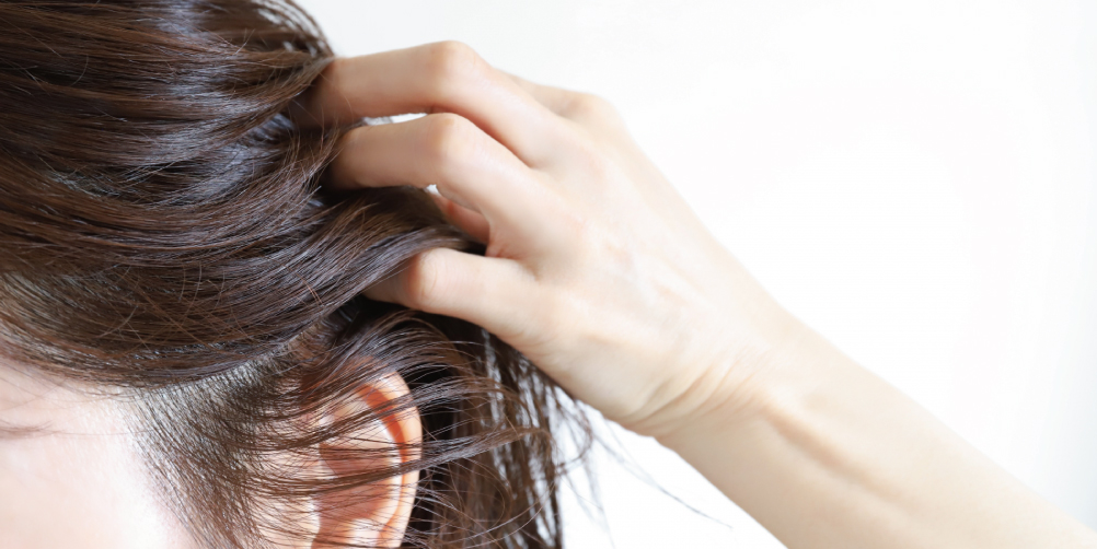 頭皮ケアに悩む女性の画像